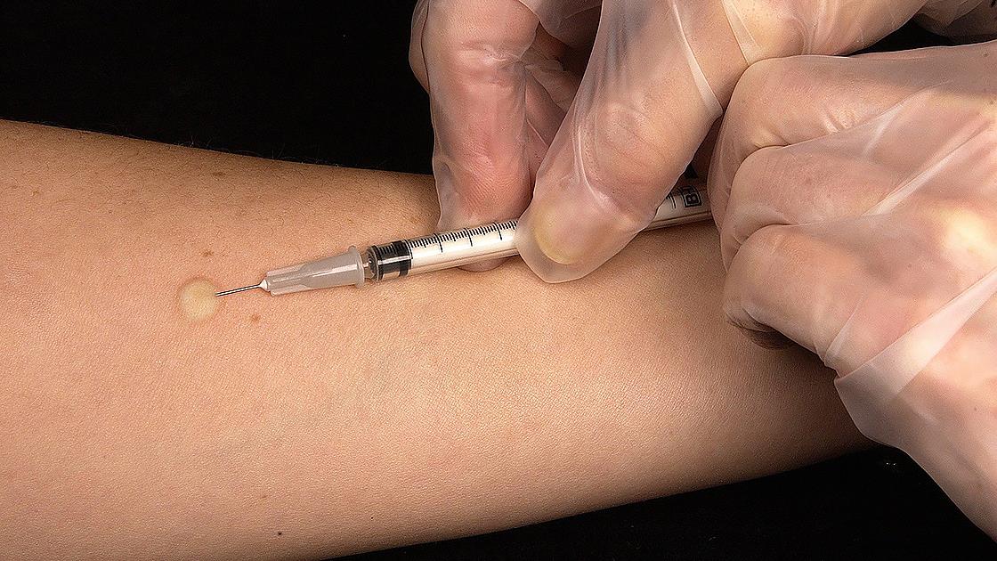 Kuduzda “aşı” ve “koruyucu tedbirler” hayat kurtarıyor