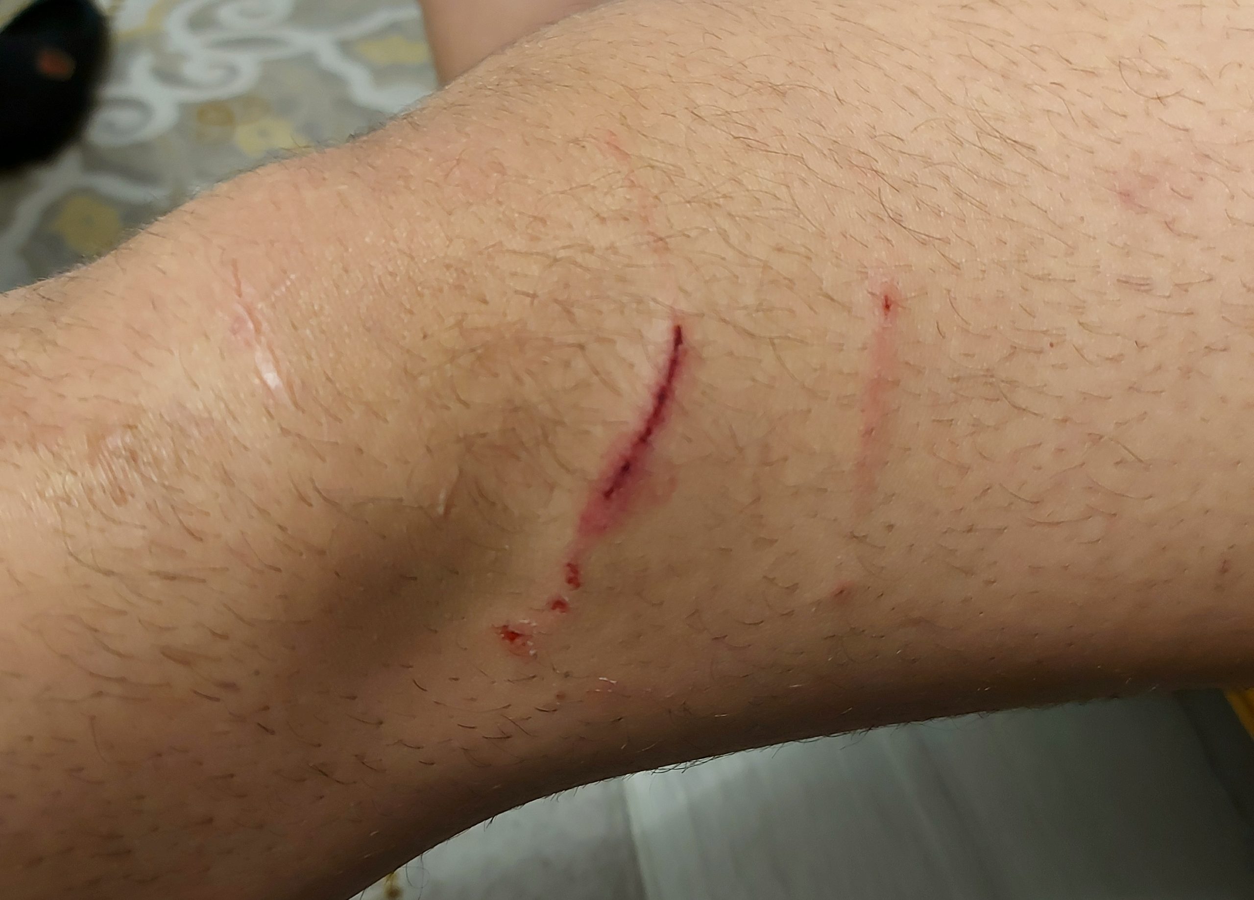 Köpekler Konusunda, Kocaeli’de Acil Önlemler Alınması  Şarttır !